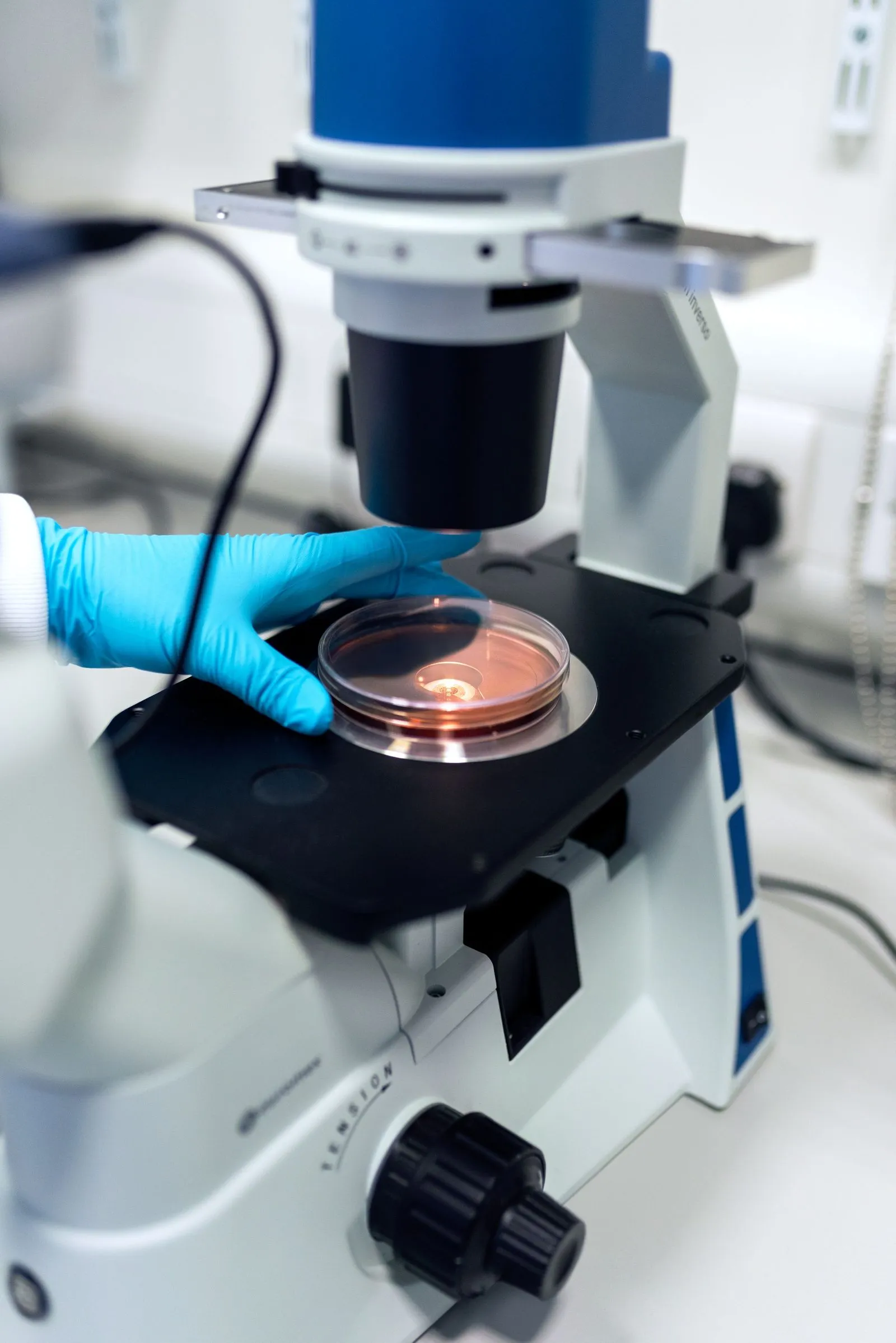 Placa de cultivo bajo un microscopio en un laboratorio